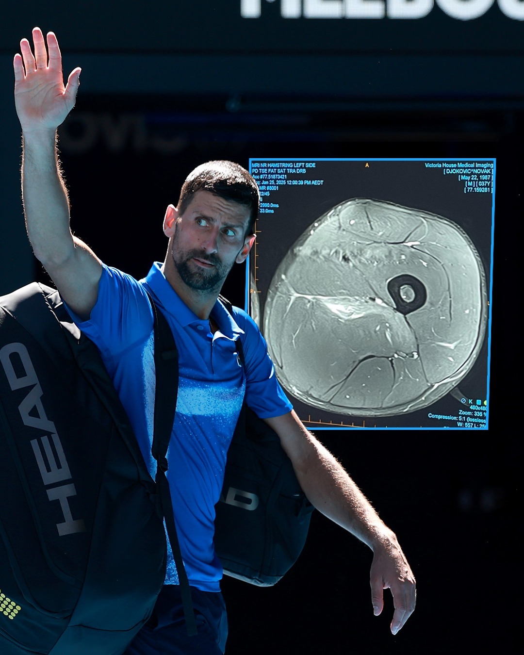 包含澳大利亚网球队爆冷法国网球队，德约科维奇爆发神勇的词条